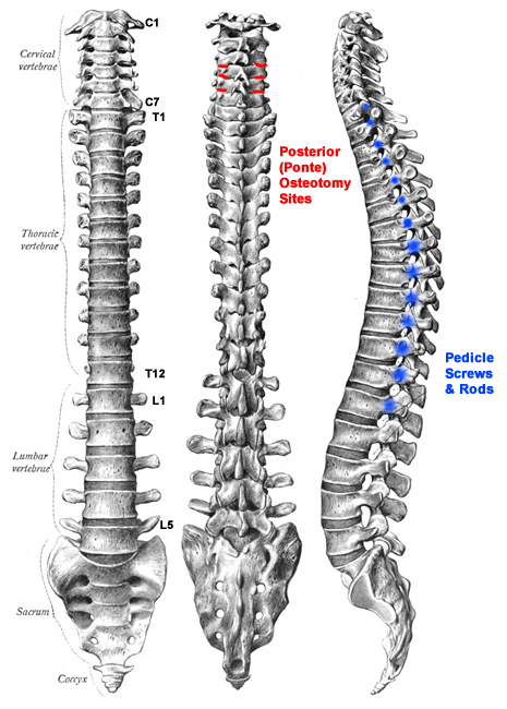 Jordan: Cleidocranial Dysostosis